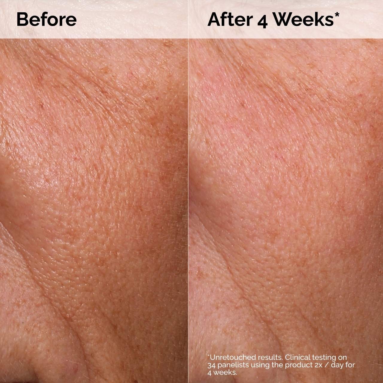 THE ORDINARY - Hyaluronic Acid 2% + B5 Hydrating Serum - Image 7