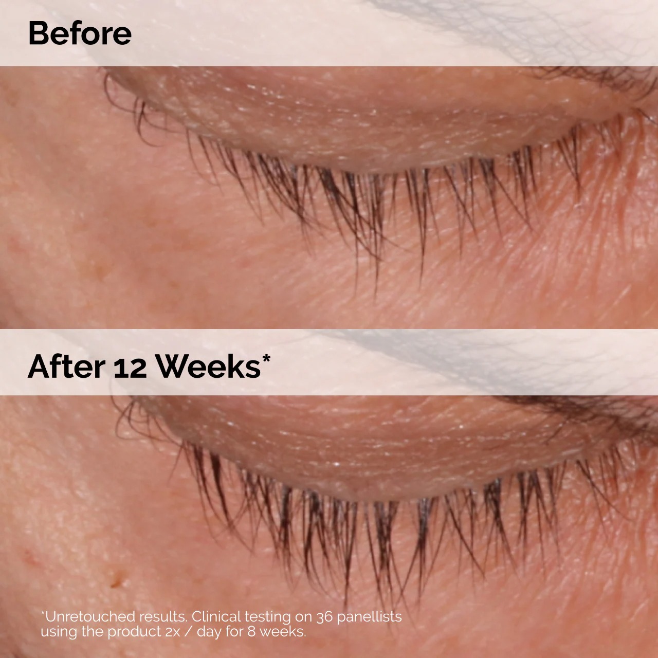 THE ORDINARY - Multi-Peptide Lash and Brow Serum - Image 6