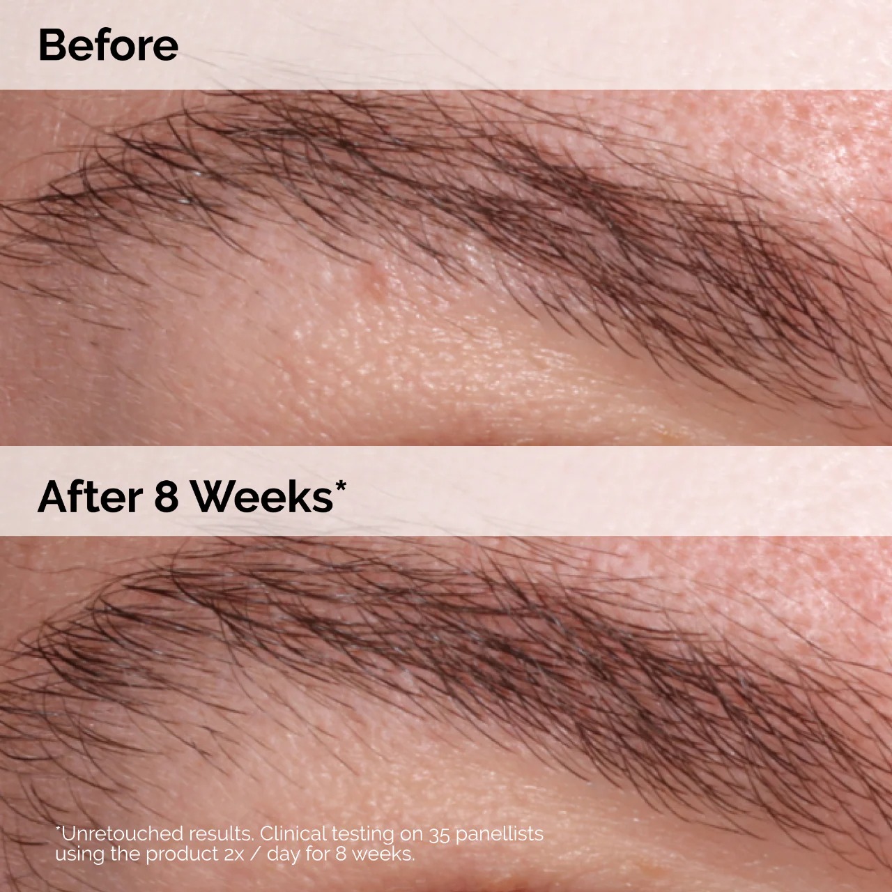 THE ORDINARY - Multi-Peptide Lash and Brow Serum - Image 7