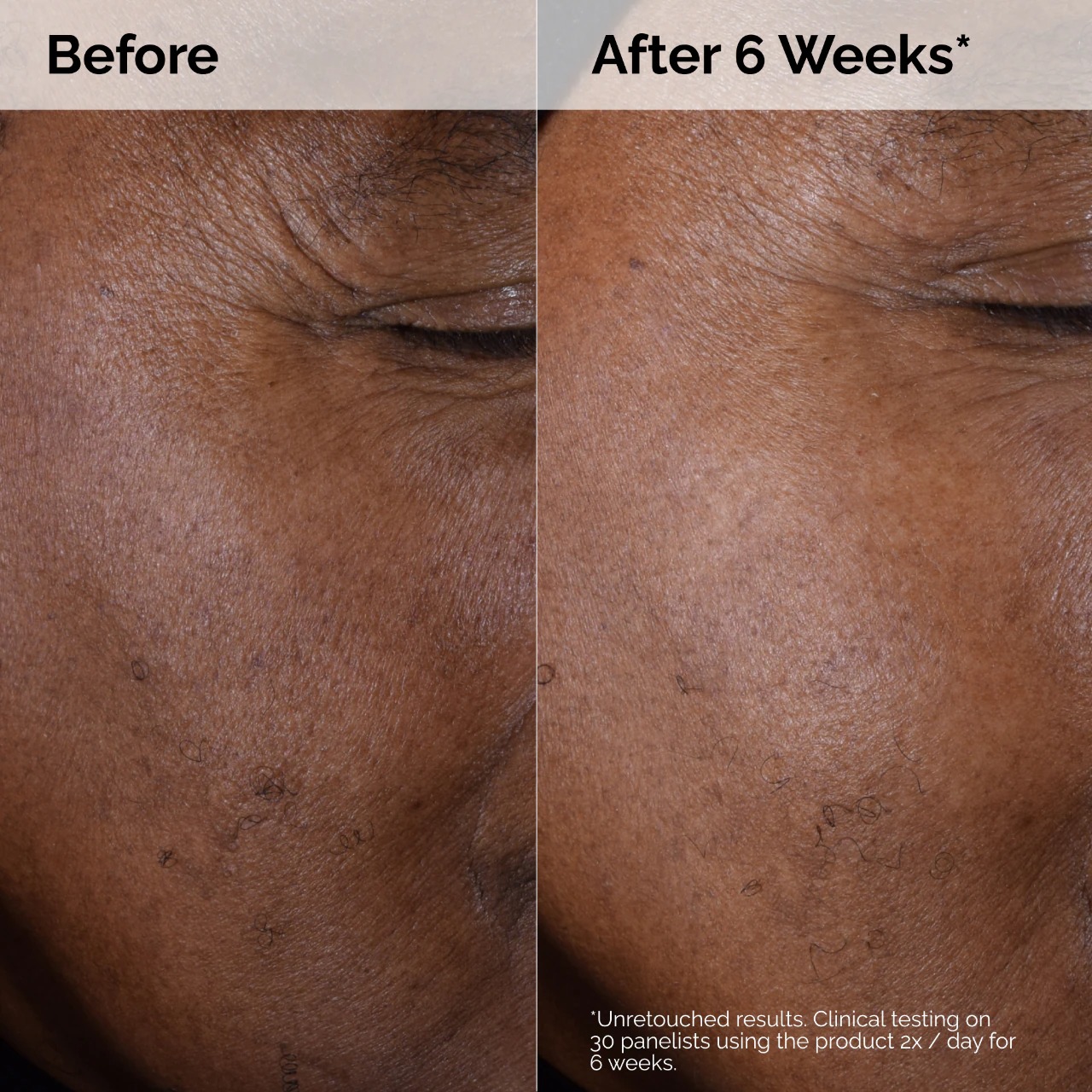 THE ORDINARY - Glycolic Acid 7% Exfoliating Toner - Image 6