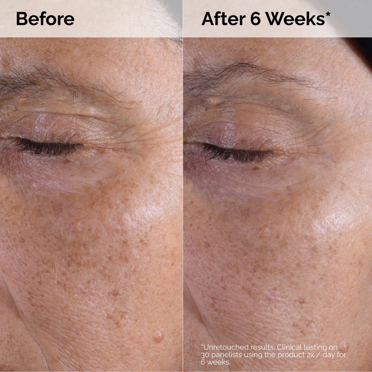 THE ORDINARY - Glycolic Acid 7% Exfoliating Toner - Image 7