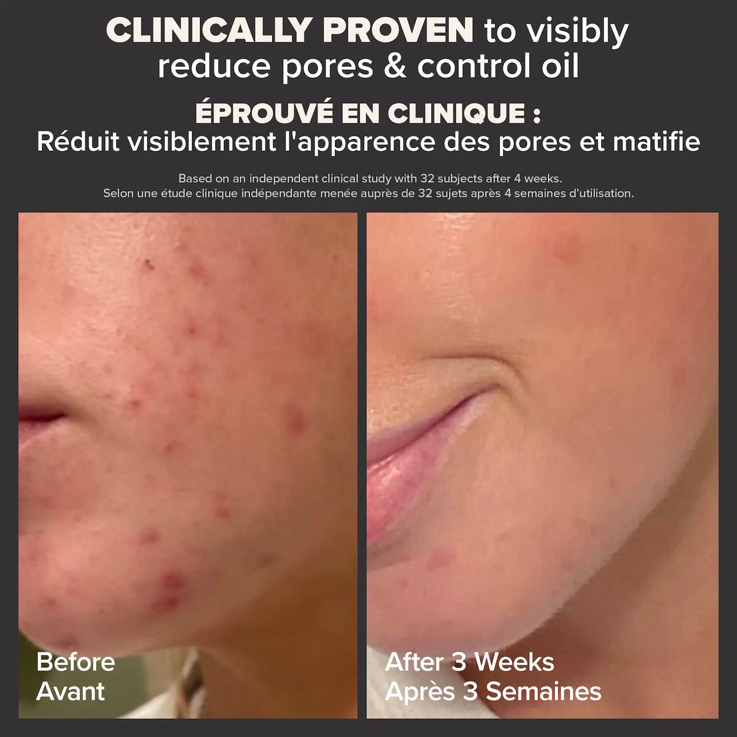 PAULA'S CHOICE - Skin Perfecting 2% BHA Liquid Exfoliant - Image 6