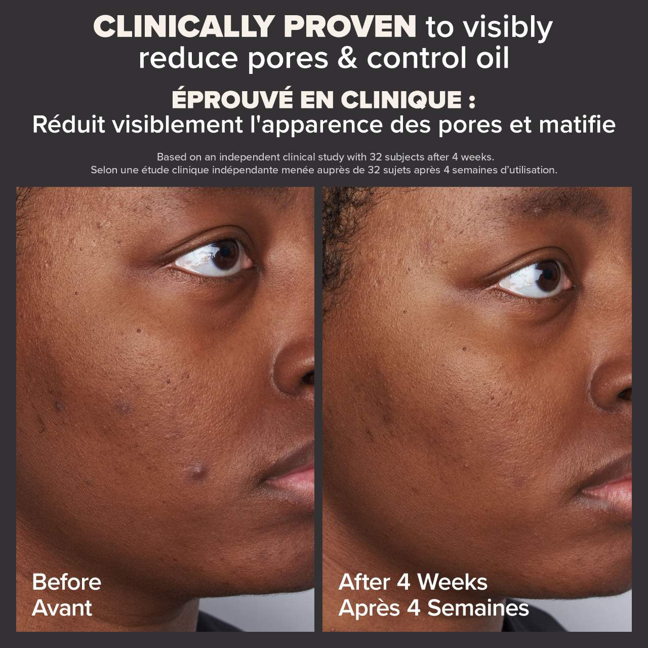 PAULA'S CHOICE - Skin Perfecting 2% BHA Liquid Exfoliant - Image 7