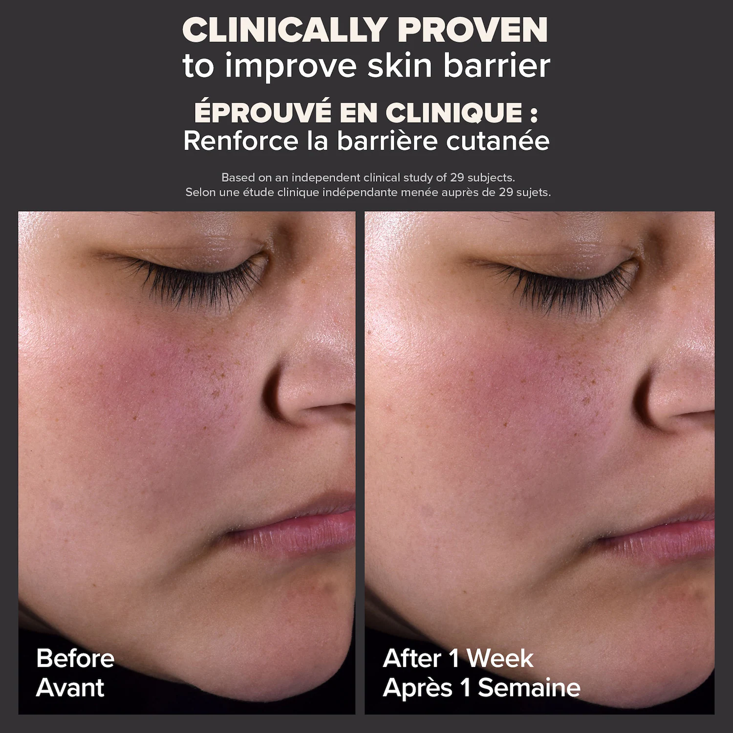 PAULA'S CHOICE - Skin Perfecting 2% BHA Liquid Exfoliant - Image 8